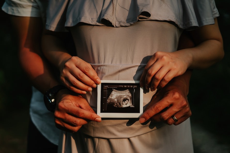 Outdoor Maternity Shoot Singapore